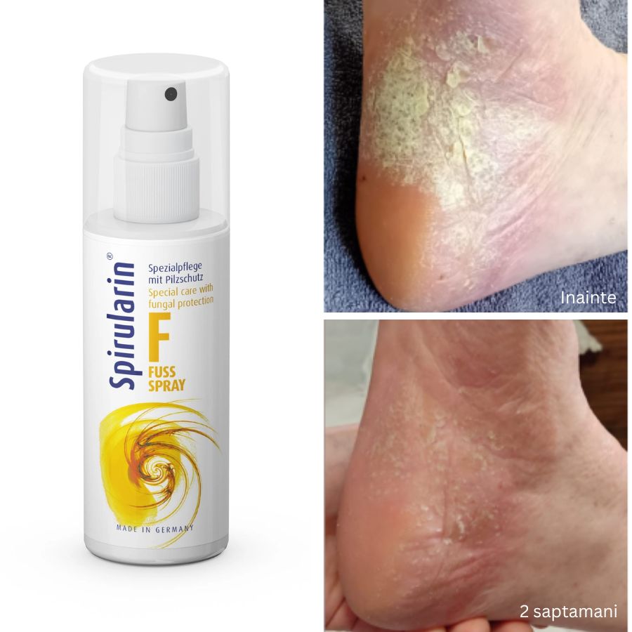 Spray pentru picioare Spirularin ® F 100 ml - imagine 2