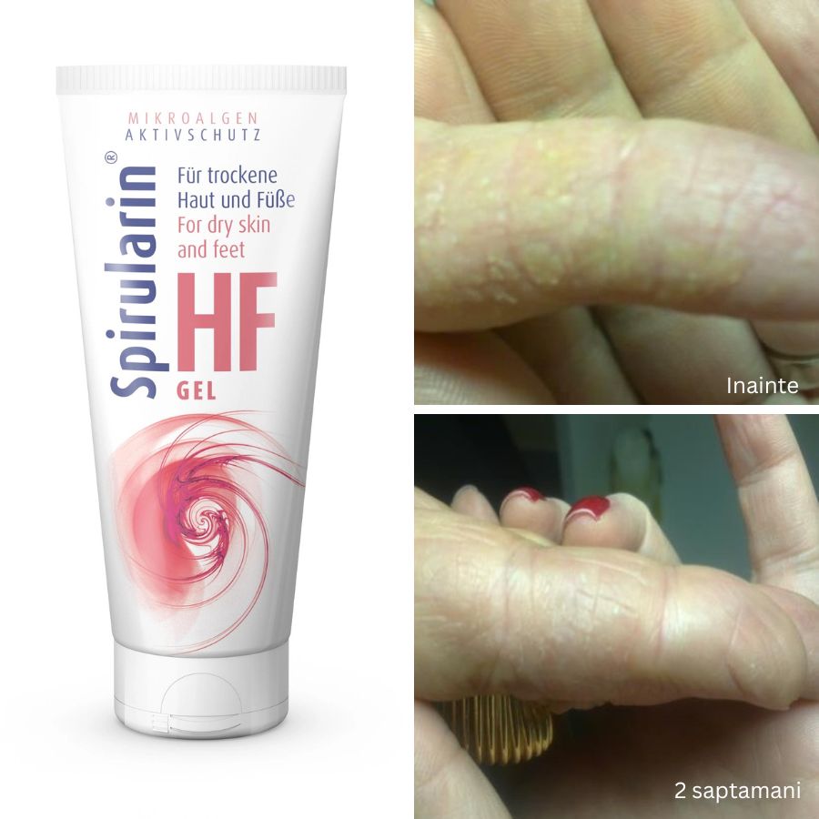 Gel hidratant cu protectie impotriva microorganismelor Spirularin®HF 40ml