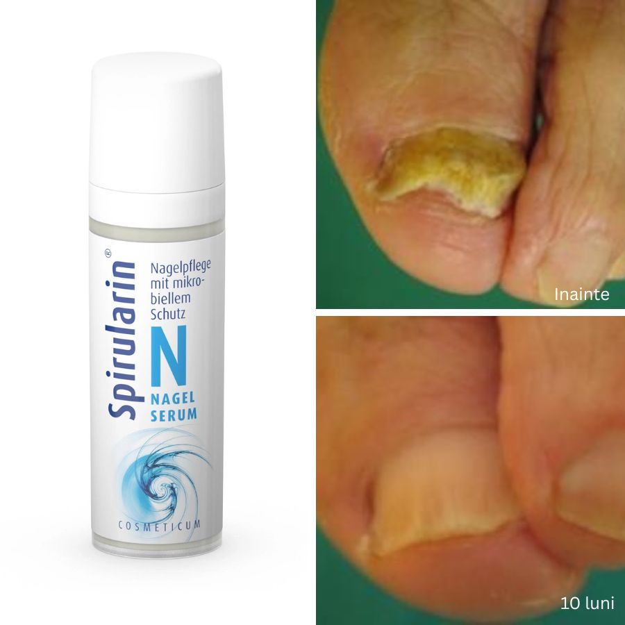 Ser regenerare unghii problematice Spirularin® N 30ml