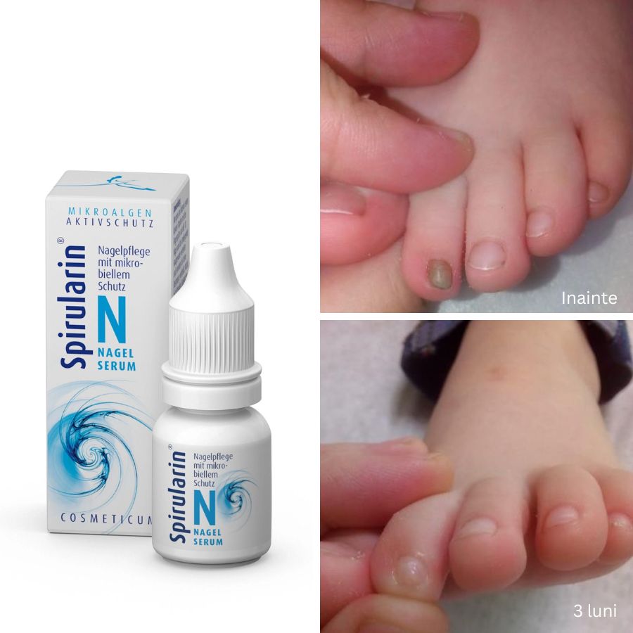 Ser regenerare unghii problematice Spirularin® N 30ml
