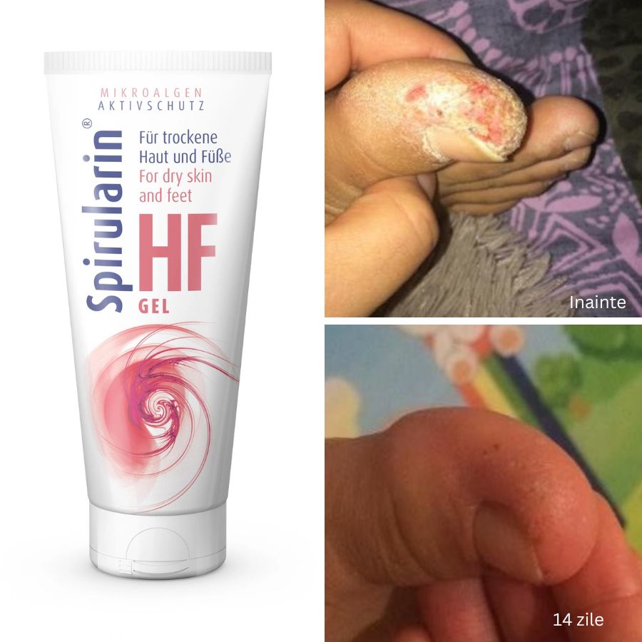 Gel hidratant cu protectie impotriva microorganismelor Spirularin®HF 40ml